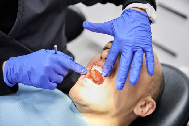 Trusted CA Emergency Dental Service Experts